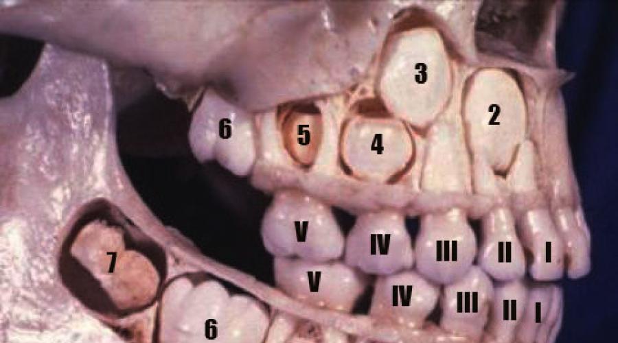 Дистопия зуба. Что нужно делать с дистопированными зубами