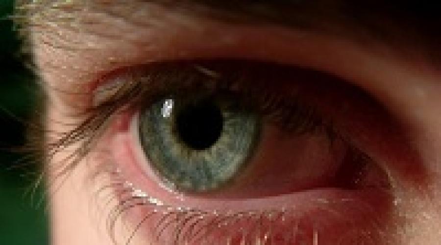 Осложнения после замены хрусталика глаза при катаракте. Отек после операции и как его снять Отек роговицы после операции лечение