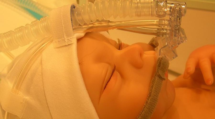 Новорожденный тяжело дышит. Аппарат ИВЛ реанимация новорожденных. Асфиксия новорождённых ИВЛ. Асфиксия недоношенного ребенка. Сипап аппарат для новорожденных недоношенных детей.