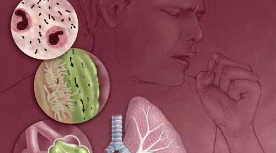 Пневмония течение болезни. Как вовремя распознать симптомы воспаления лёгких 