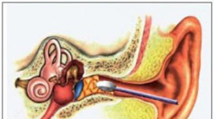 Почему ушная сера сухая? Ушная сера расскажет все о вашем здоровье. 