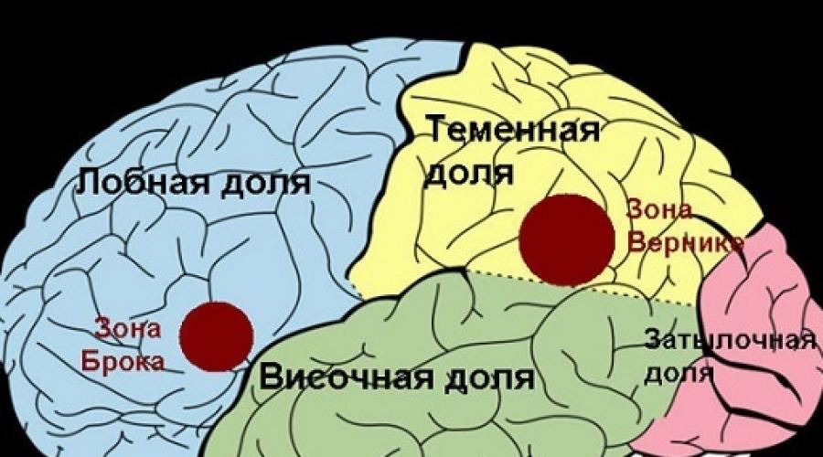 Зона брока и вернике. Центр Вернике и центр Брока. Мозг зоны Брока и Вернике. Центр Брока в головном мозге.