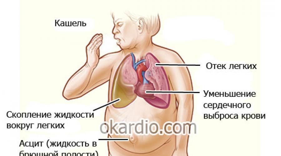 Отек сердца. Отек от сердца симптомы.