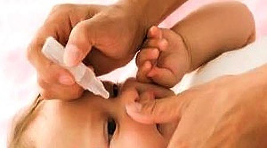 Как бороться с конъюнктивитом у новорожденных. Гнойный конъюнктивит у новорожденного чем лечить