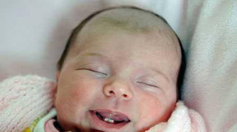 Новорожденный ребенок с зубами. Отвечаем на вопрос: почему ребенок родился с зубами