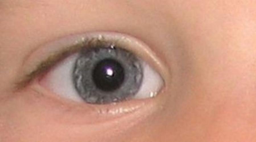 Рак роговицы глаза. Симптоматика и лечение опухоли на глазу