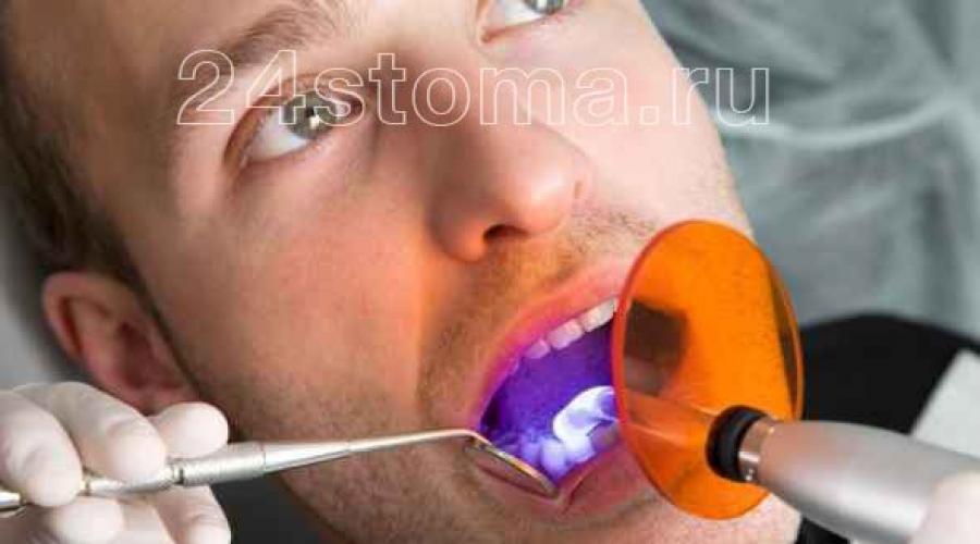Пришеечный кариес зубов. Как лечить пришеечный кариес